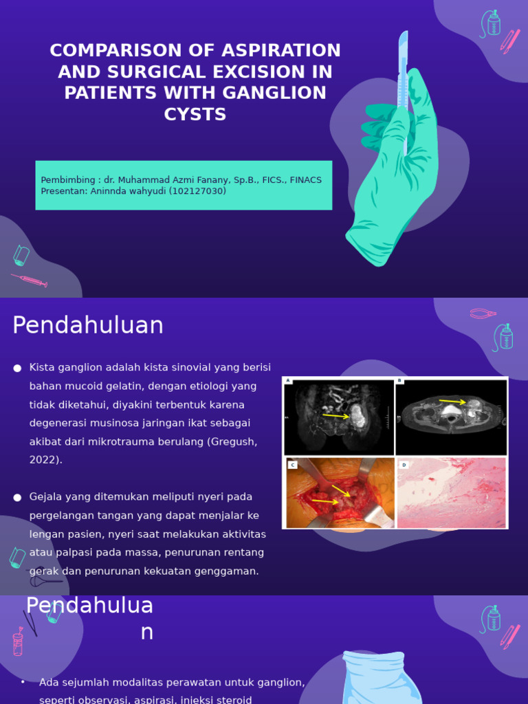 Aspirasi vs Eksisi Kista Ganglion | PDF