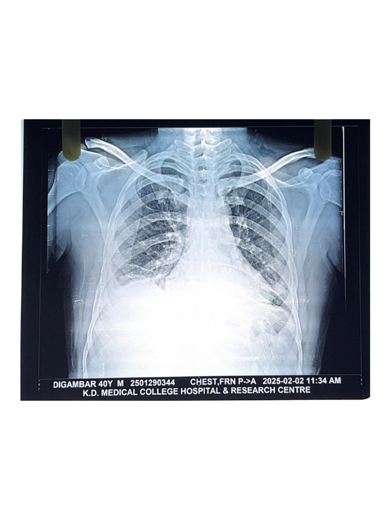X Ray | PDF