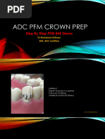 PFM Crown Preparation Guidelines | PDF | Anatomical Terms Of Location ...