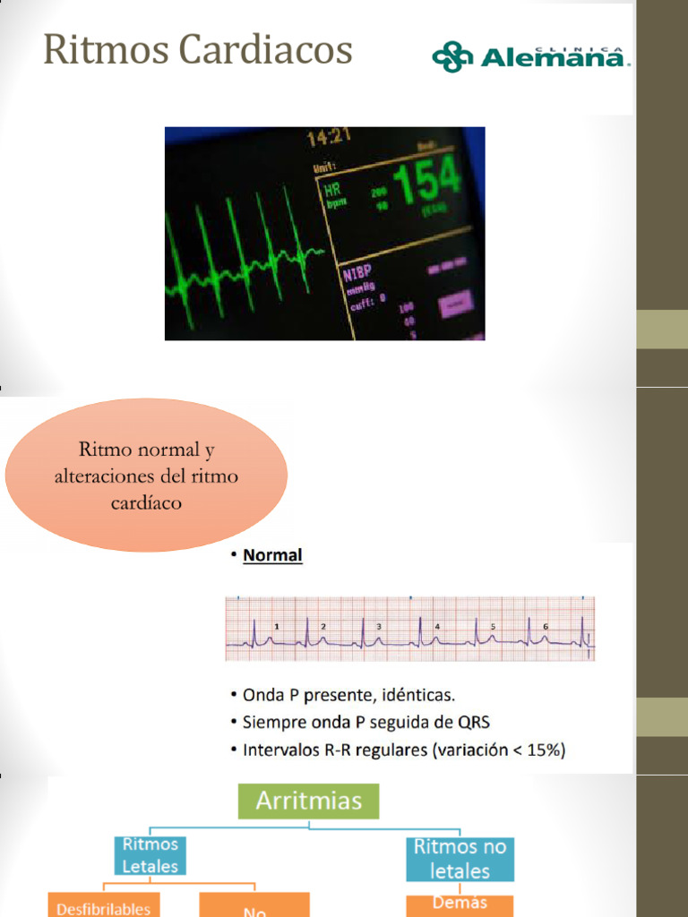Ritmos Cardiacos y Taquiarritmias | PDF | Cardiología | Sistema ...