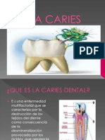 La Caries