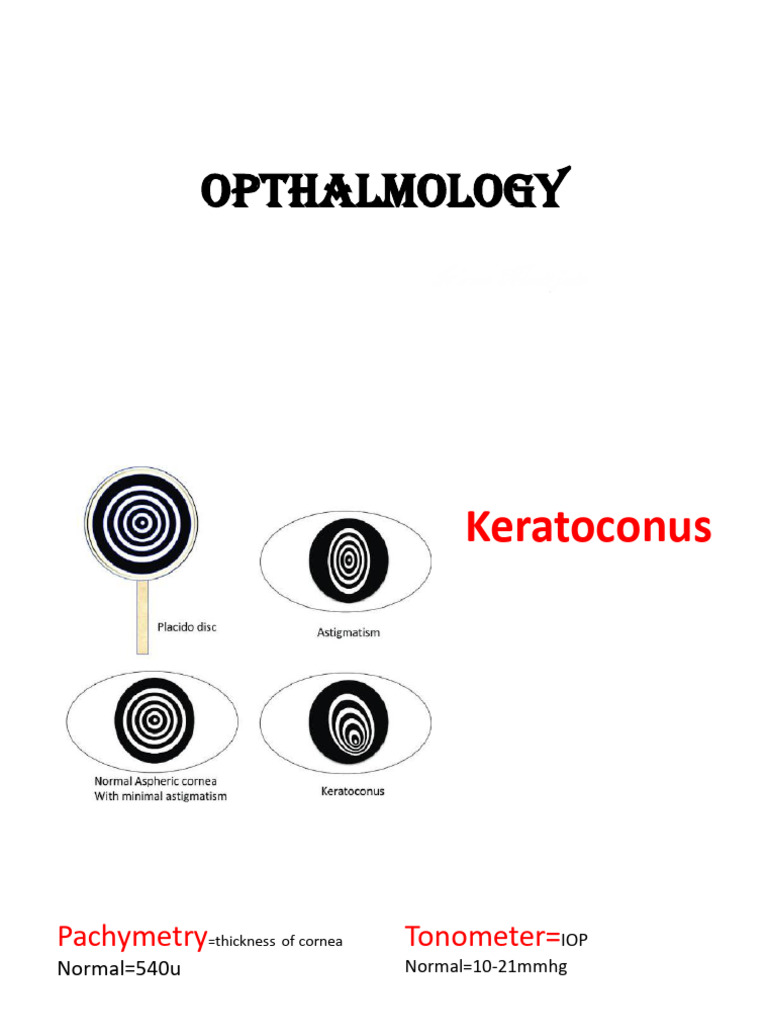 Comprehensive Ophthalmology Overview | PDF | Cataract | Glaucoma