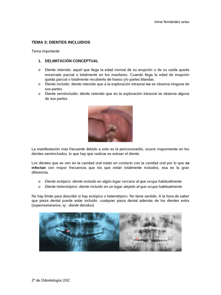 Dientes Incluidos: Definición y Tratamiento | PDF | Diente | Odontología