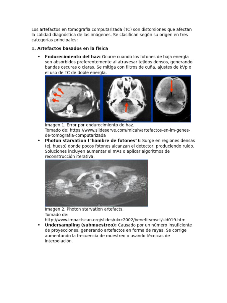 Artefactos En TC De 16 Slice Causas Y Soluciones PDF Ct Scan
