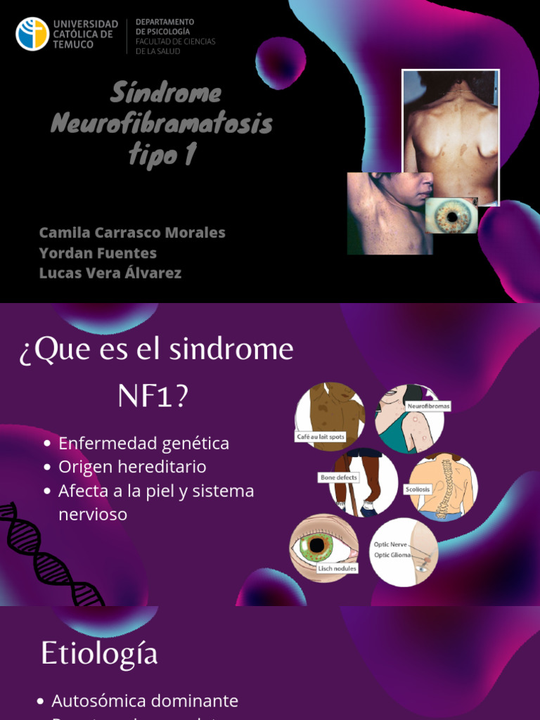 Síndrome Neurofibromatosis Tipo 1: Guía Completa | PDF | Especialidades ...