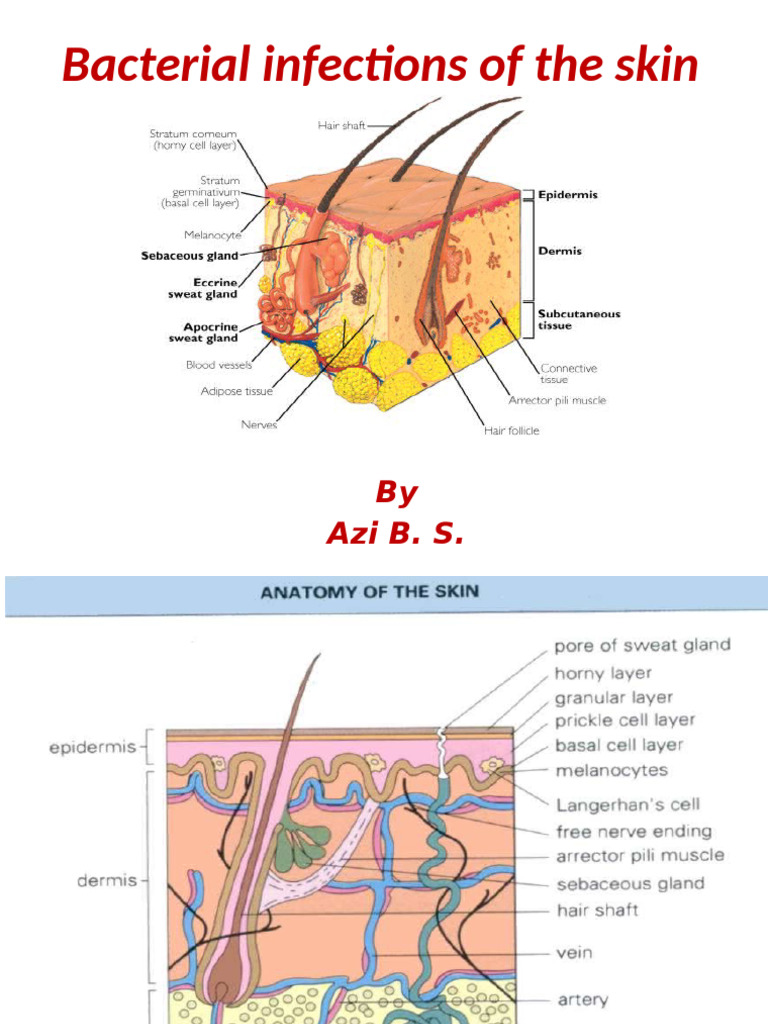 Staphylococcal Skin Infections Overview | PDF | Tuberculosis ...