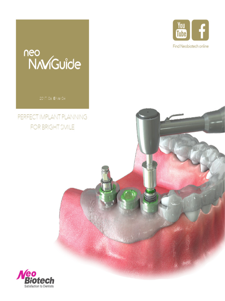 Neo NaviGuide Implant Planning Guide | PDF | Dental Implant | Surgery