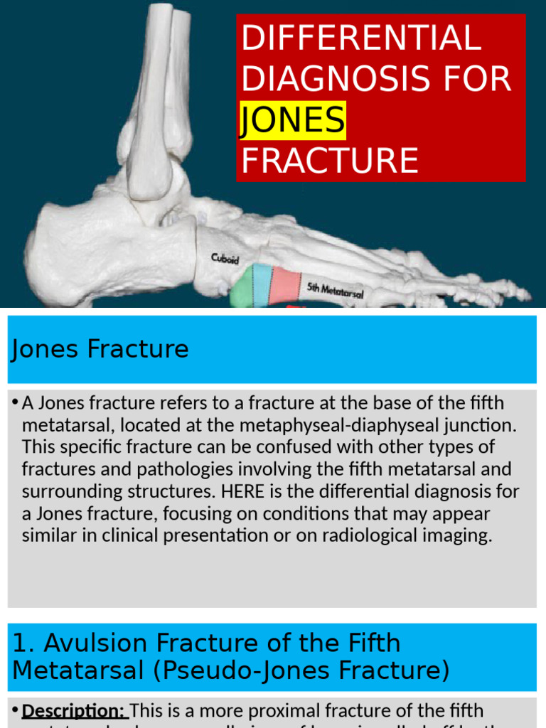 Jones Fracture Differential Diagnosis | PDF | Musculoskeletal Disorders ...