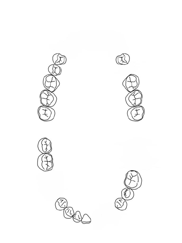 Case A D RPD Template | PDF