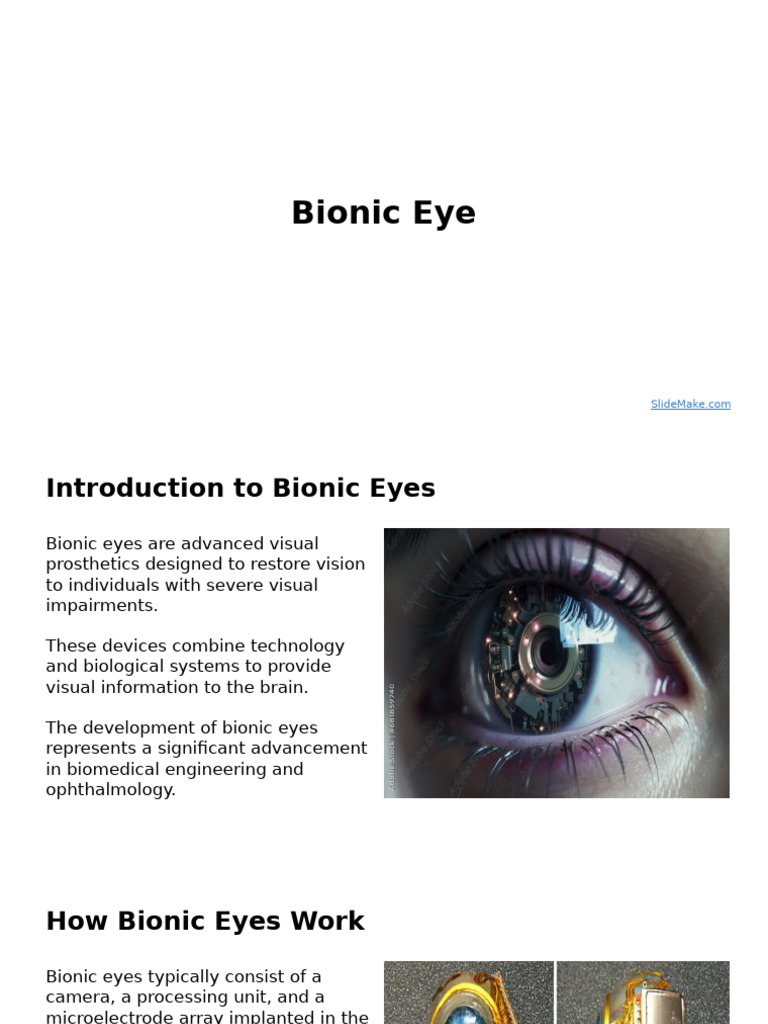 Understanding Bionic Eye Technology | PDF | Neuroscience | Vision