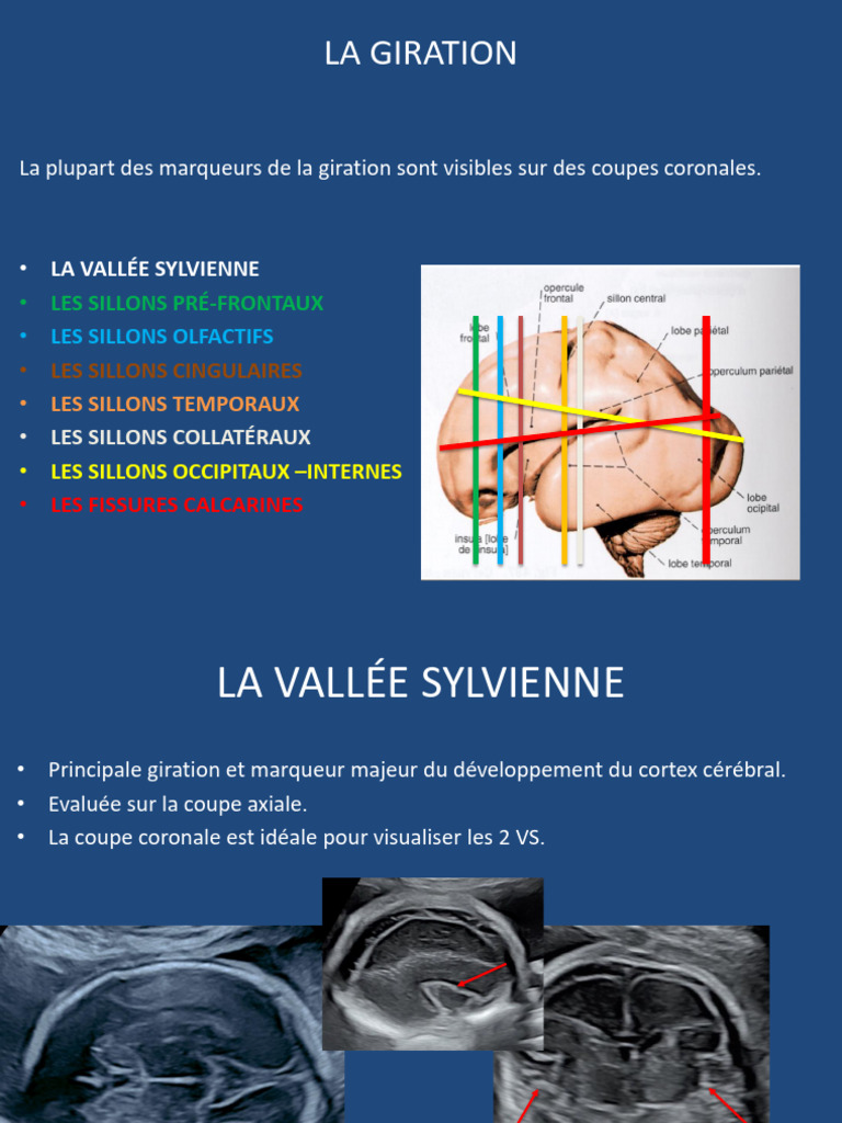 Anatomie de la vallée sylvienne | PDF | Cortex insulaire ...