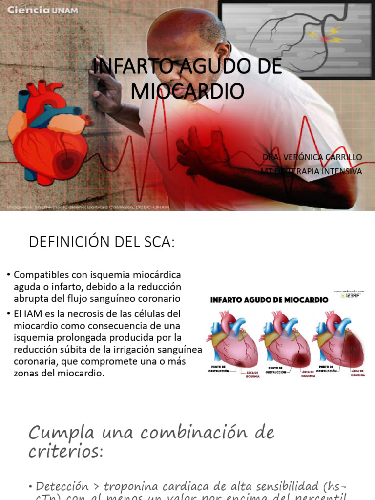 Iam 3 | PDF | Infarto de miocardio | Isquemia