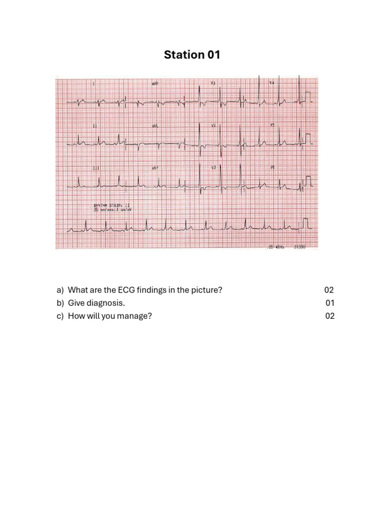 ECGs | PDF | Electrocardiography | Cardiology