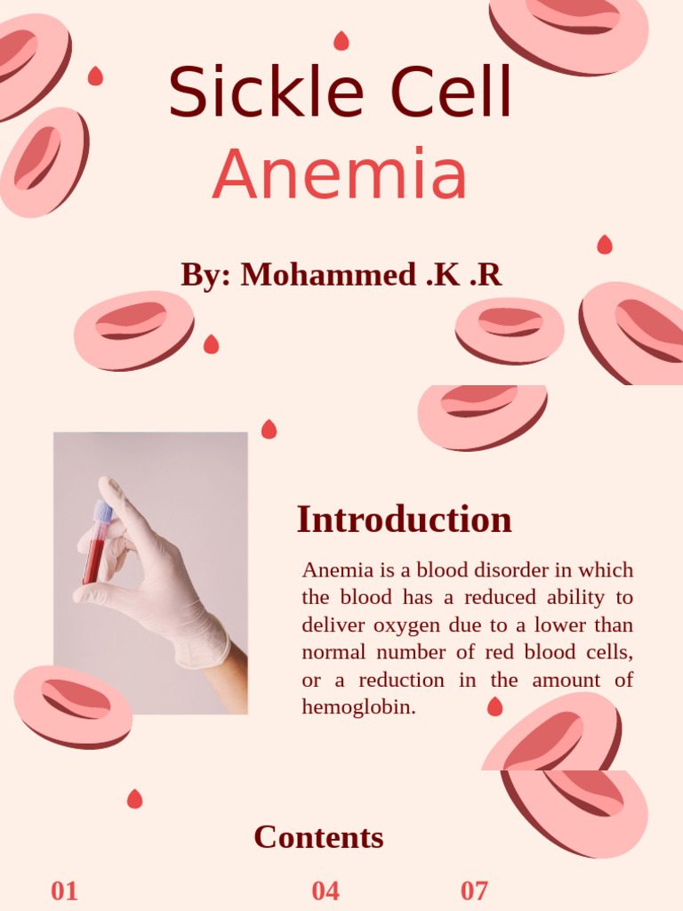 Sickle Cell Anemia Overview and Management | PDF | Anemia | Diseases ...