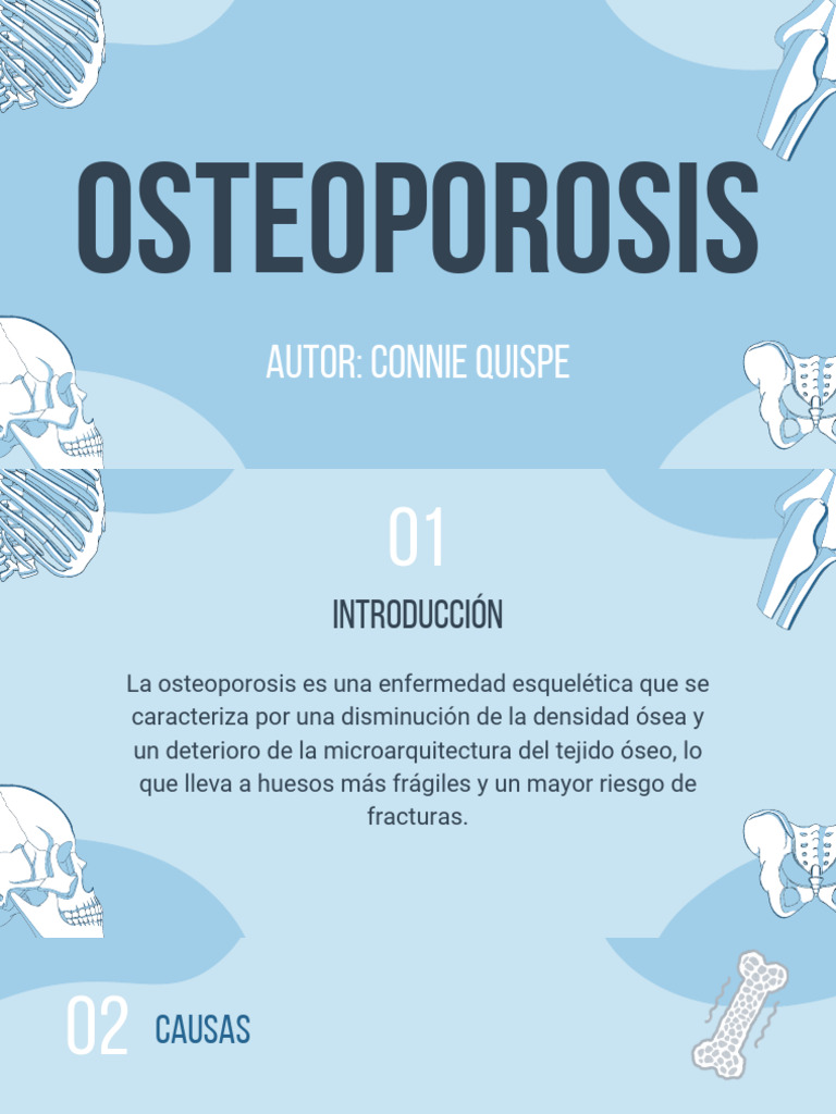 Guía Completa sobre Osteoporosis | PDF