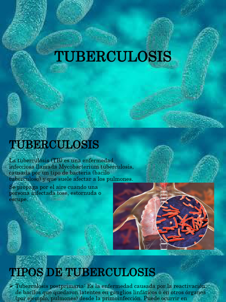Síntomas y tipos de tuberculosis | PDF | Tuberculosis | Medicina CLINICA