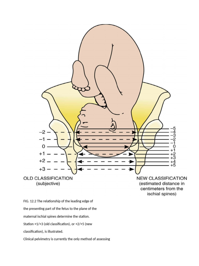 Understanding Fetal Station in Labor | PDF