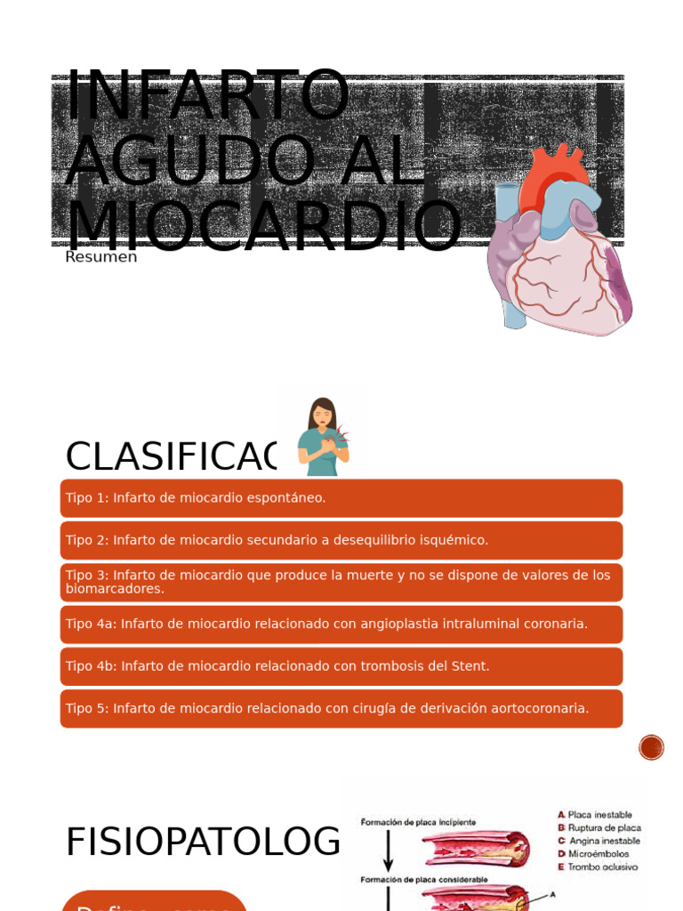Clasificación y diagnóstico del infarto cardíaco | PDF | Infarto de ...