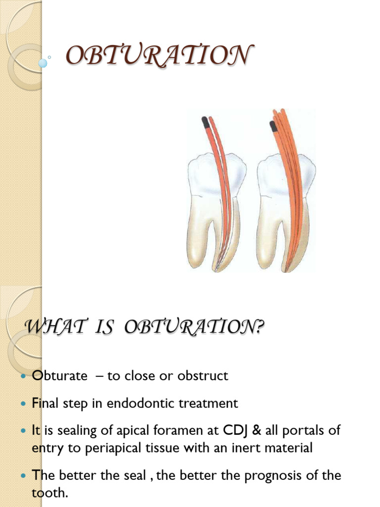 Understanding Root Canal Obturating Techniques | PDF | Materials