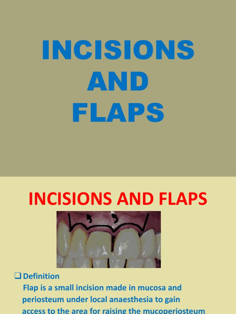 Incisions and Flaps Dentistry Human Head And Neck