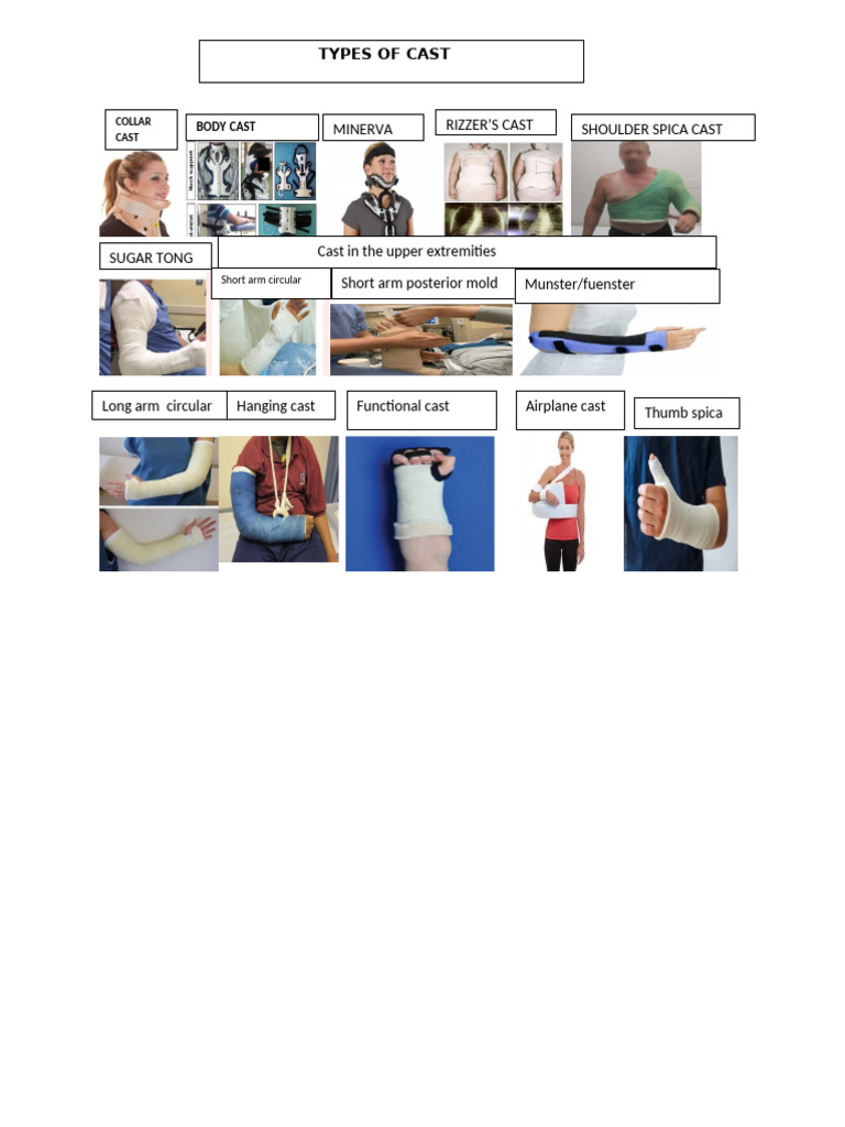 Types of Casts for Upper Extremities | PDF