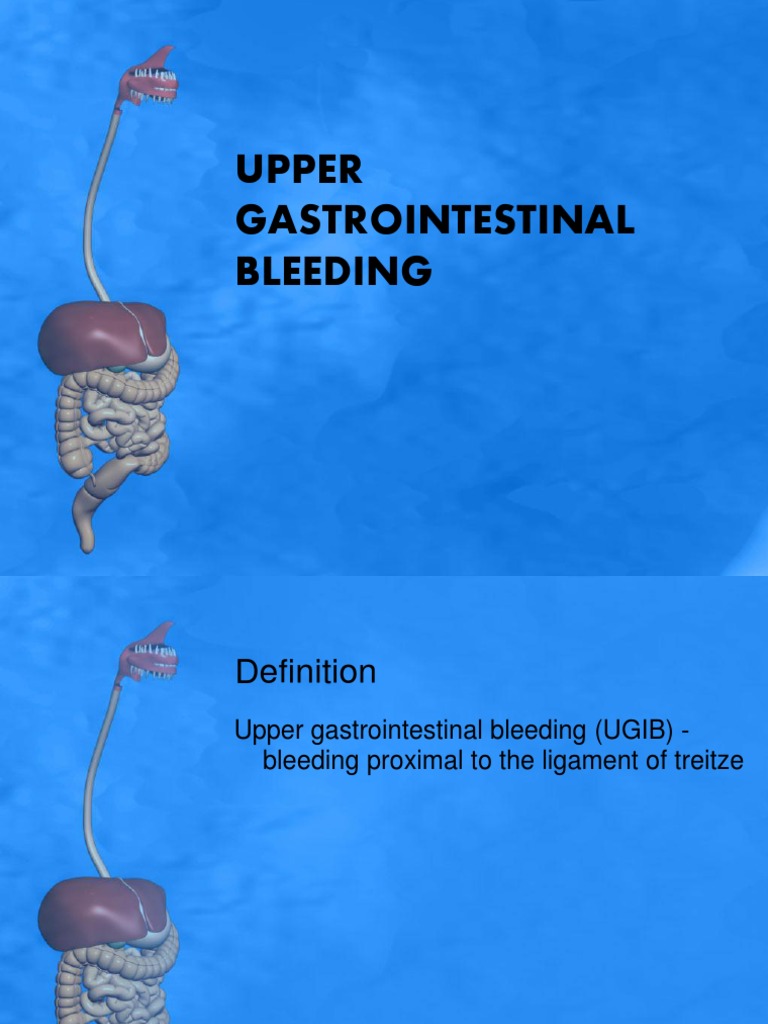 Upper Gastrointestinal Bleeding Overview | PDF | Science & Mathematics