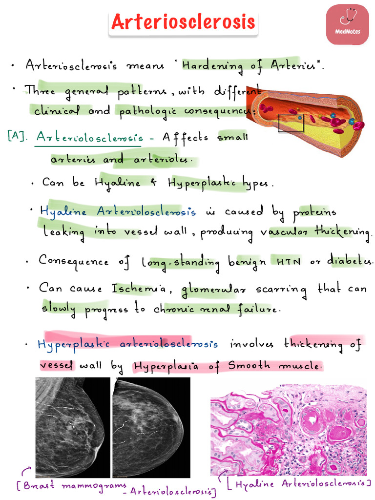 Arteriosclerosis | PDF | Atherosclerosis | Atheroma