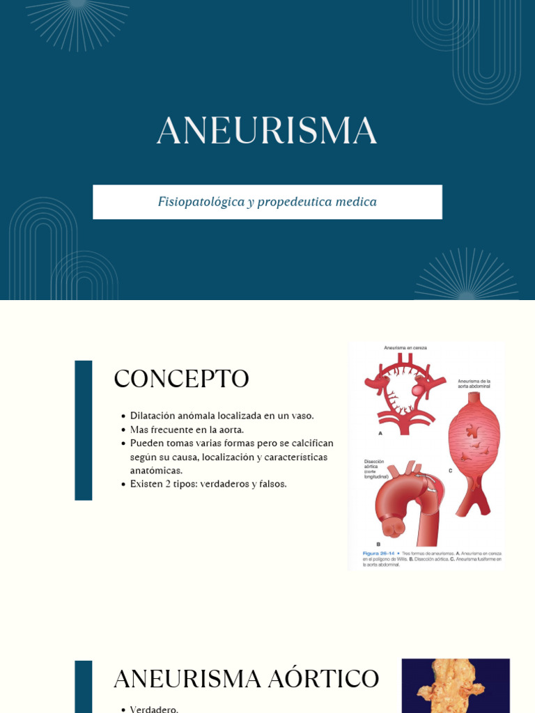 Aneurisma Aórtico: Diagnóstico y Tratamiento | PDF