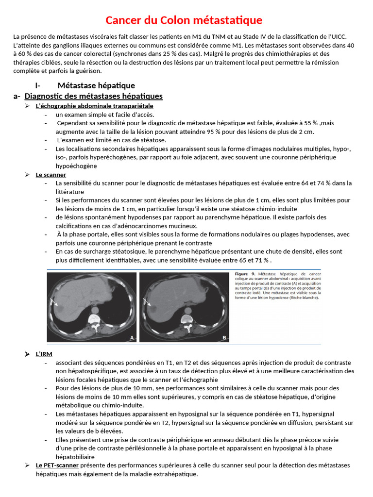 M tastases H patiques Dans Le Cancer Colorectal PDF Cancer Du C lon 