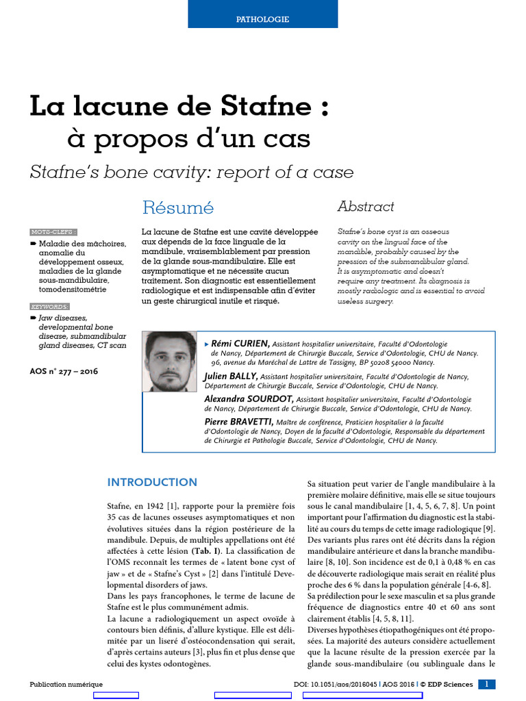 Lacune de Stafne : Diagnostic et Cas | PDF | Tomodensitométrie ...