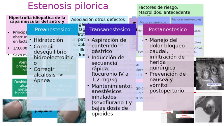 Estenosis Pilorica | PDF