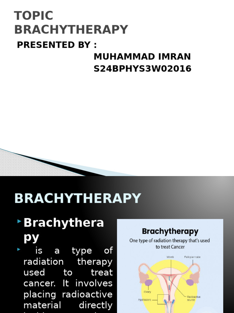Brachytherapy for Cervical Cancer | PDF | Radiation Therapy | Medicine