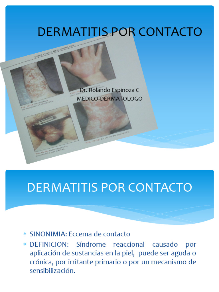 Guía Completa sobre Dermatitis por Contacto | PDF | Alergia | Sistema ...