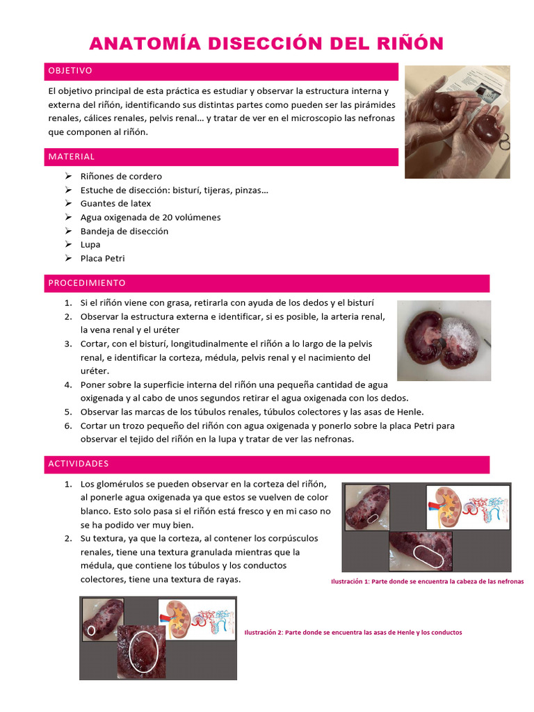 Anatomía y Disección del Riñón | PDF