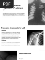 Proyecciones Radiográficas de Hombro | PDF