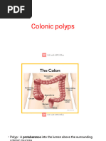 Haggitt Classification of Colorectal Polyps | PDF | Colorectal Cancer ...