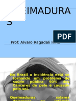 Queimaduras: causas, graus, tratamento e cuidados