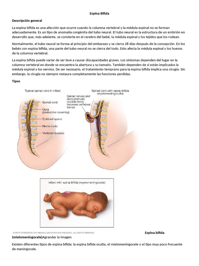 Espina Bifida: Tipos y Síntomas | PDF | Especialidades Medicas