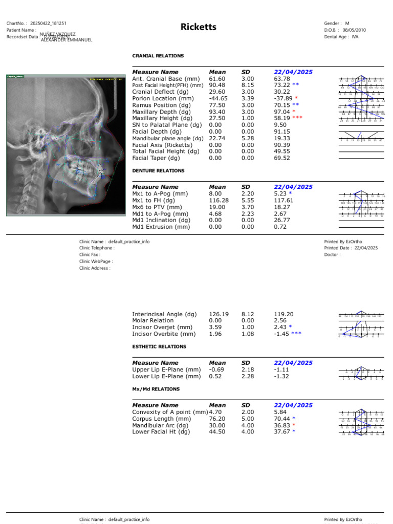 Ricketts Analysis for Patient Nuñez | PDF | Dental Anatomy | Dentistry ...