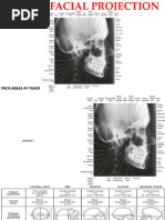 Towne View Techniques in Extraoral Radiography | PDF | Skull | Human ...