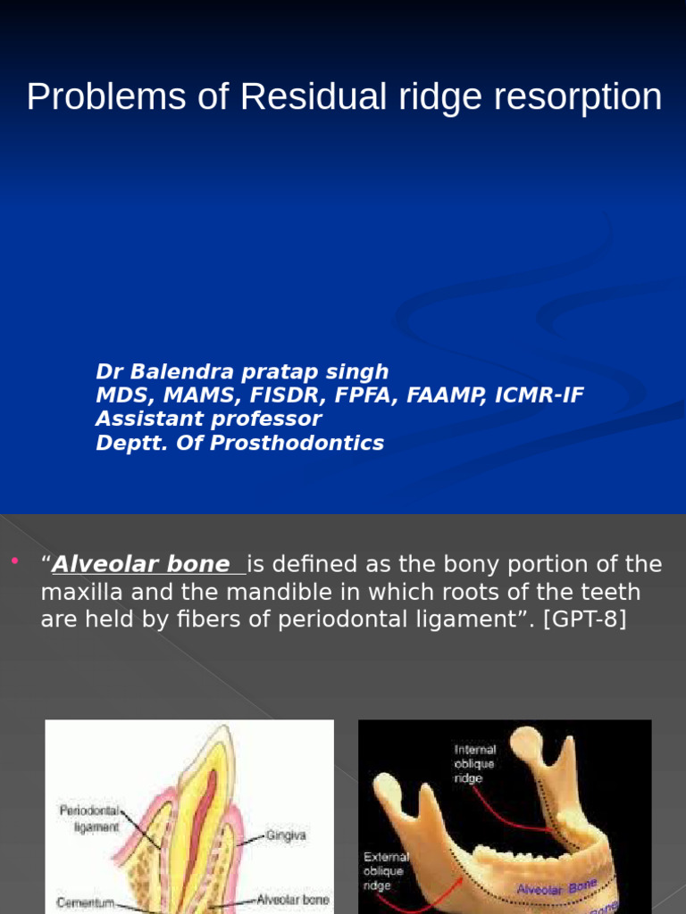 Factors Influencing Ridge Resorption | PDF | Dentures | Bone