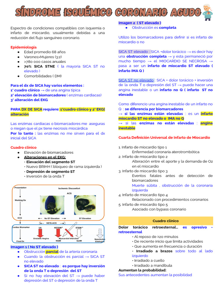 Diagnóstico y tratamiento de SICA | PDF | Infarto de miocardio | Medicina