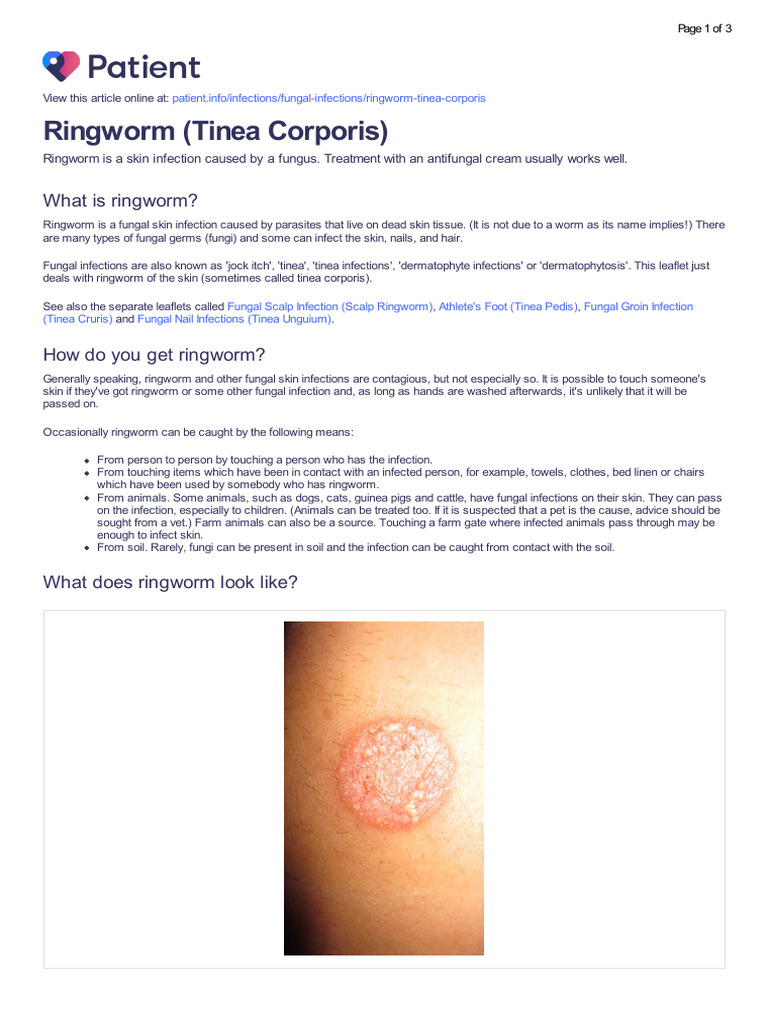 Understanding Ringworm (Tinea Corporis) | PDF | Dermatology | Human ...