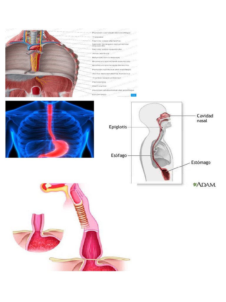 Esofago 2 | PDF