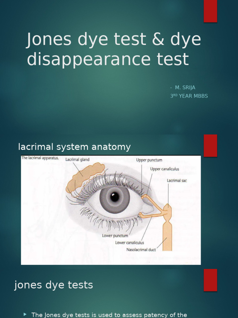 Jones Dye Tests for Lacrimal Patency | PDF