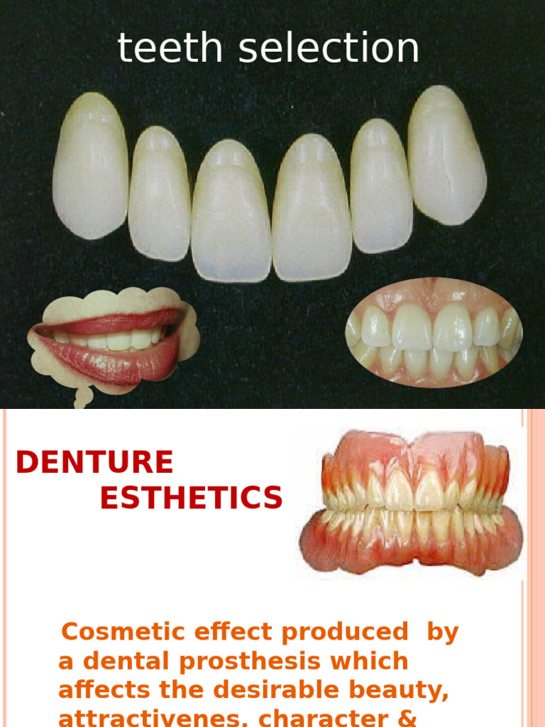 Anterior Teeth Selection Guidelines | PDF | Tooth | Dentures