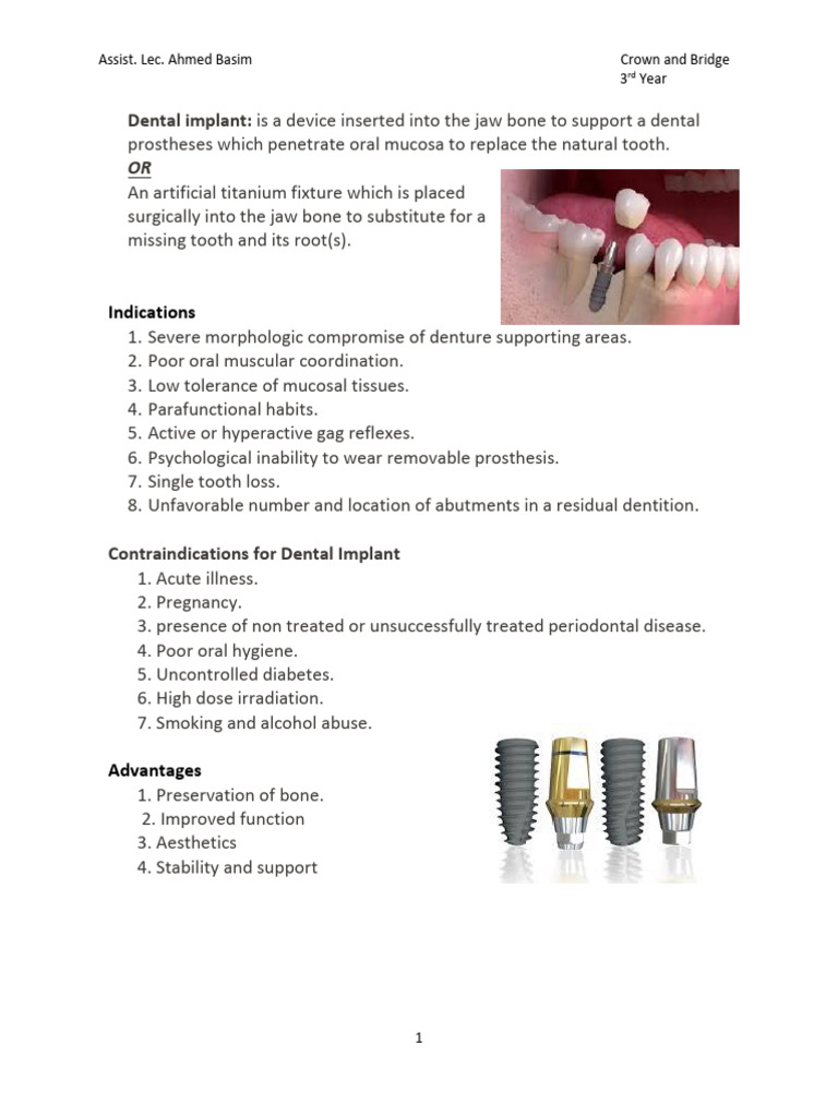 Dental Implants: Types, Benefits, and Risks | PDF | Dental Implant ...