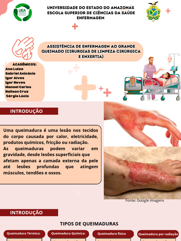Assistência de Enfermagem a Queimados | PDF | Queimadura ...