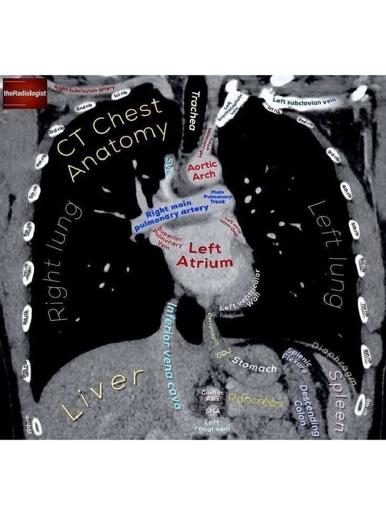 CT Chest Ep-02 | PDF