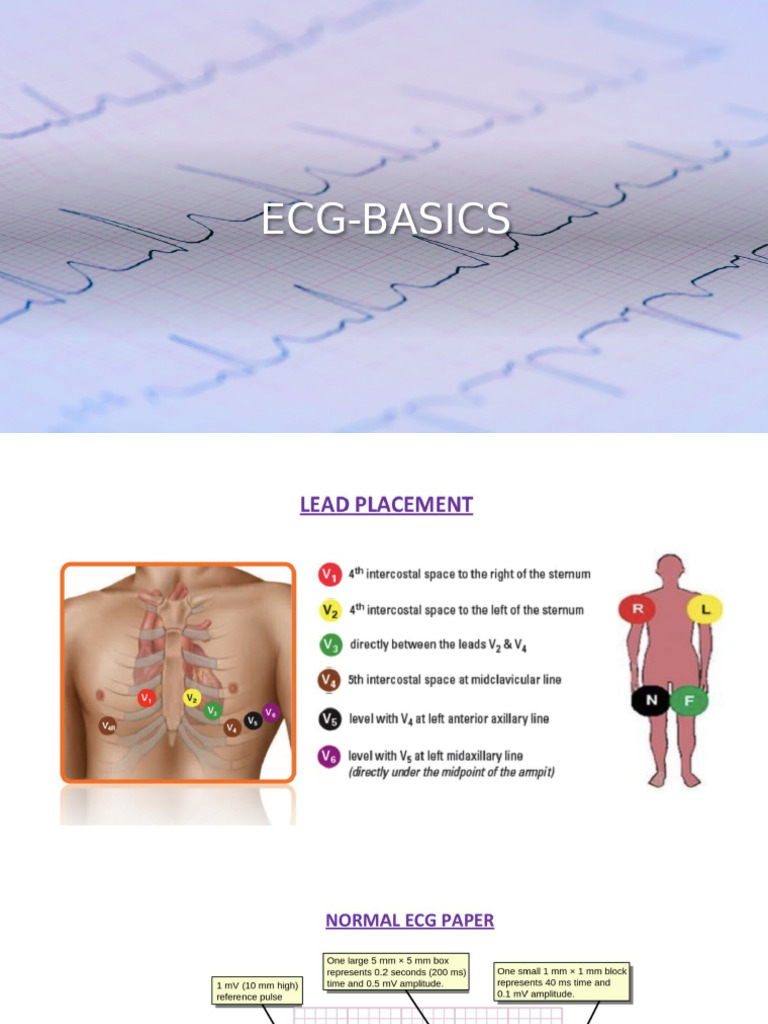 Ecg - Hs Training | PDF